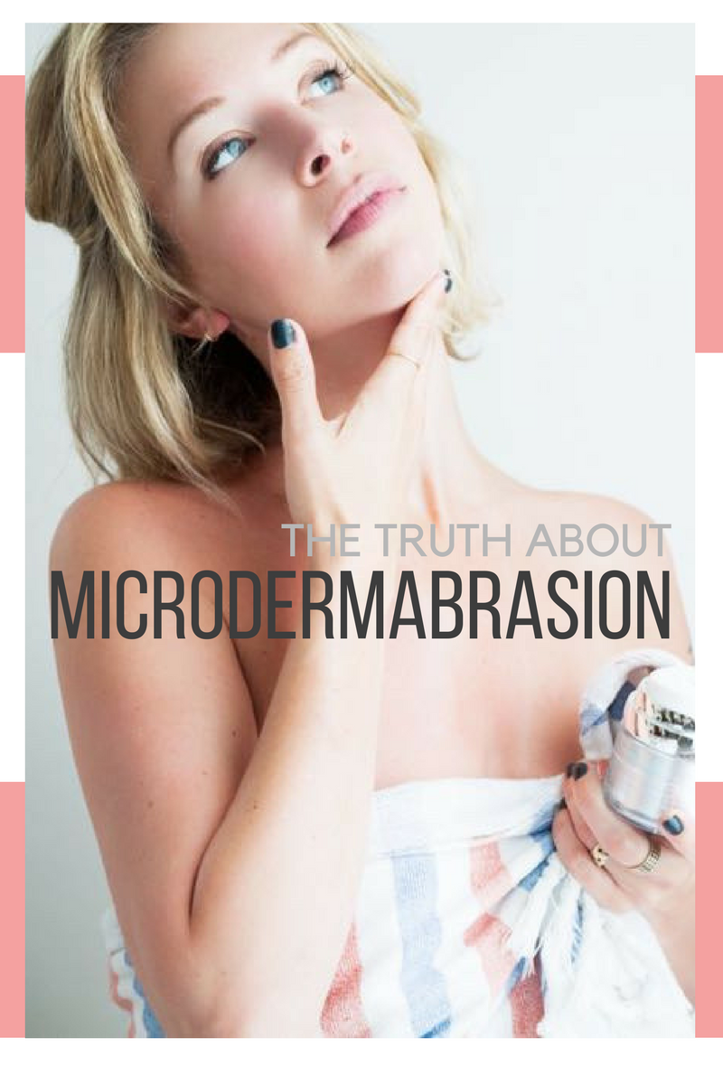does microdermabrasion work for adult acne